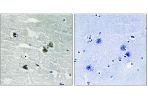Immunohistochemistry analysis of paraffin-embedded human brain tissue using MER/SKY (Phospho-Tyr749/681) antibody. (MER/SKY (pTyr681), (pTyr749) Antikörper)