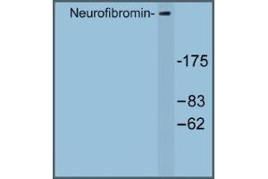 Image no. 1 for anti-Neurofibromin 1 (NF1) antibody (ABIN317682) (Neurofibromin 1 Antikörper)