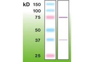 Image no. 1 for anti-Protein Kinase C, beta (PRKCB) antibody (ABIN6756685) (PKC beta Antikörper)