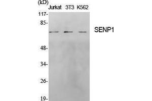 Western Blotting (WB) image for anti-SUMO1/sentrin Specific Peptidase 1 (SENP1) (N-Term) antibody (ABIN3186898) (SENP1 Antikörper  (N-Term))