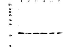 Western blot analysis of IL10 using anti-IL10 antibody . (IL-10 Antikörper  (AA 19-178))
