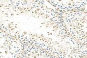 Immunohistochemistry analysis of paraffin-embedded rat testis using,RPAP2 (ABIN7075481) at dilution of 1: 1000 (RPAP2 Antikörper)