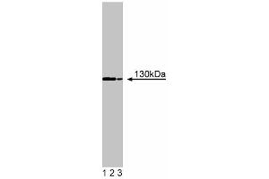 Western blot analysis of FYB on a Jurkat cell lysate (Human T-cell leukemia, ATCC TIB-152) .