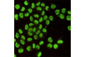 Immunofluorescent analysis of Hela cells using Ku80 mouse mAb (1:400). (XRCC5 Antikörper)