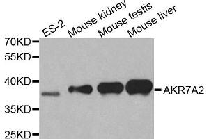 Western blot analysis of extracts of various cell lines, using AKR7A2 antibody. (AKR7A2 Antikörper  (AA 100-359))