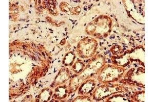 Immunohistochemistry of paraffin-embedded human kidney tissue using ABIN7174788 at dilution of 1:100 (C1ORF189 Antikörper  (AA 1-101))