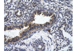 Rabbit Anti-ZFR Antibody       Paraffin Embedded Tissue:  Human bronchiole epithelium   Cellular Data:  Epithelial cells of renal tubule  Antibody Concentration:   4. (ZFR Antikörper  (Middle Region))