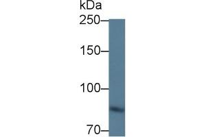 Detection of ITGb6 in Mouse Kidney lysate using Polyclonal Antibody to Integrin Beta 6 (ITGb6)