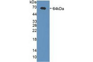 Figure. (GABRA2 Antikörper  (AA 42-250))
