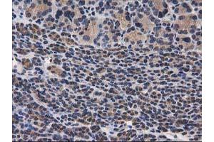 Image no. 16 for anti-Destrin (Actin Depolymerizing Factor) (DSTN) antibody (ABIN1497910) (Destrin Antikörper)