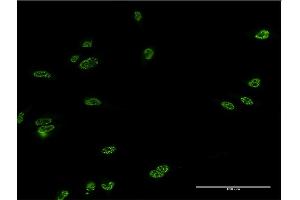 Immunofluorescence of monoclonal antibody to LHX4 on HeLa cell. (LHX4 Antikörper  (AA 291-390))
