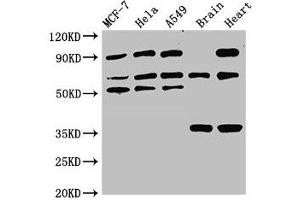 Western Blot Positive WB detected in: MCF-7 whole cell lysate, Hela whole cell lysate, A549 whole cell lysate, Rat brain tissue, Rat heart tissue All lanes: TRIM4 antibody at 3. (TRIM4 Antikörper  (AA 1-118))