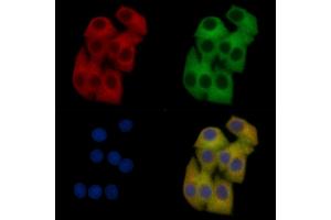 AQP2 Mouse Monoclonal Antibody staining Hela cells by IF/ICC. (AQP2 Antikörper)
