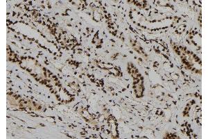 ABIN6273186 at 1/100 staining Human kidney tissue by IHC-P. (WDR46 Antikörper  (Internal Region))