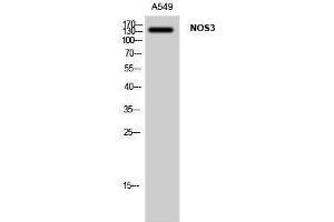 Western Blotting (WB) image for anti-Nitric Oxide Synthase 3 (Endothelial Cell) (NOS3) (Thr180), (Tyr182) antibody (ABIN3185941) (ENOS Antikörper  (Thr180, Tyr182))