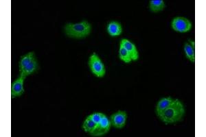 Immunofluorescence staining of HepG2 cells with ABIN7156745 at 1:100, counter-stained with DAPI. (IL1R1 Antikörper  (AA 18-320))