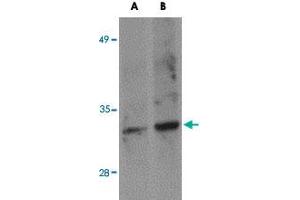 Western blot analysis of SKA1 in A-549 NE cell lysate with SKA1 polyclonal antibody  at (A) 0. (SKA1 Antikörper  (C-Term))