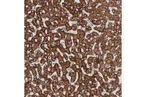 Immunohistochemical staining of human liver with ARSD polyclonal antibody  shows strong cytoplasmic positivity with a granular pattern in hepatocytes. (Arylsulfatase D Antikörper)