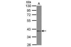 Image no. 2 for anti-Decapping Enzyme, Scavenger (DCPS) (AA 1-149) antibody (ABIN1497779)