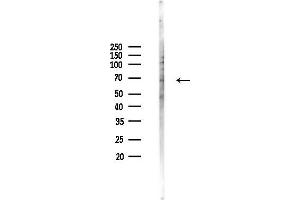 Western blot analysis of lysates from COLO205 cells(heat-shock,45 min treatment), using SLC22 Antibody at 1/1000 dilution.