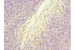 Immunohistochemistry of paraffin-embedded human thymus tissue using ABIN7174771 at dilution of 1:100 (C19orf48 Antikörper  (AA 1-117))