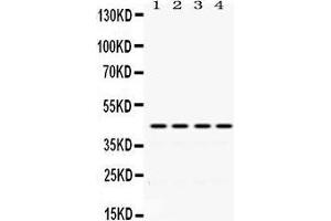 Western Blotting (WB) image for anti-Actin, alpha 1, Skeletal Muscle (ACTA1) (AA 277-308), (C-Term) antibody (ABIN3043519) (Actin Antikörper  (C-Term))