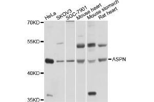 Western blot analysis of extracts of various cell lines, using ASPN antibody (ABIN4902960) at 1:1000 dilution. (Asporin Antikörper)
