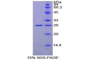 SDS-PAGE analysis of Rat GSTk1 Protein. (GSTK1 Protein)