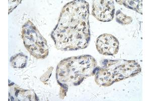 Rabbit Anti-PPARD antibody        Paraffin Embedded Tissue:  Human Placenta cell   Cellular Data:  Epithelial cells of renal tubule  Antibody Concentration:   4. (PPARD Antikörper  (N-Term))