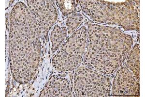 IHC analysis of HOXC4 using anti-HOXC4 antibody (ABIN7603059). (HOXC4 Antikörper  (Middle Region))