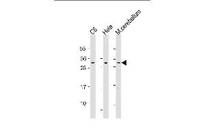 All lanes : Anti- at 1:1000 dilution Lane 1: C6 whole cell lysate Lane 2: Hela whole cell lysate Lane 3: mouse cerebellum lysate Lysates/proteins at 20 μg per lane. (PAK1IP1 Antikörper  (AA 248-277))