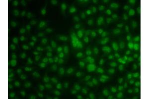 Immunofluorescence analysis of A549 cells using KLF3 antibody (ABIN5974328).