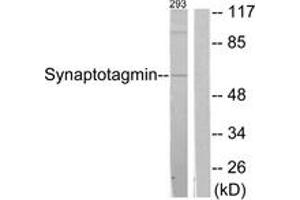 Western blot analysis of extracts from 293 cells, treated with Forskolin 40nM 30', using Synaptotagmin (Ab-309) Antibody. (Synaptotagmin Antikörper  (AA 276-325))