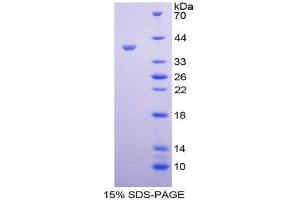 SDS-PAGE (SDS) image for Trophoblast Glycoprotein (TPBG) (AA 34-356) protein (His tag) (ABIN2127092)