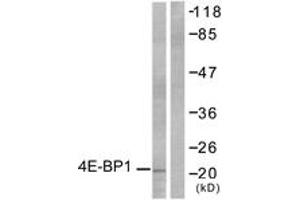 Western blot analysis of extracts from MDA-MB-435 cells, treated with EGF 200ng/ml 30', using 4E-BP1 (Ab-36) Antibody. (eIF4EBP1 Antikörper  (AA 4-53))