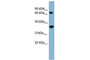 WB Suggested Anti-PPP2R1B Antibody Titration: 0. (PPP2R1B Antikörper  (N-Term))