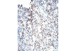 Immunohistochemistry (IHC) image for anti-Von Hippel-Lindau Tumor Suppressor, E3 Ubiquitin Protein Ligase (VHL) (AA 1-213) antibody (ABIN967508)