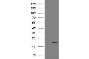 Image no. 8 for anti-Ubiquitin-Conjugating Enzyme E2G 2 (UBE2G2) antibody (ABIN1501631) (UBE2G2 Antikörper)