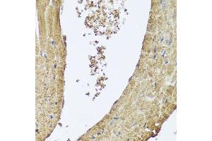Immunohistochemistry of paraffin-embedded mouse heart using PIK3C2A antibody (ABIN5995585) at dilution of 1/100 (40x lens). (PIK3C2A Antikörper)