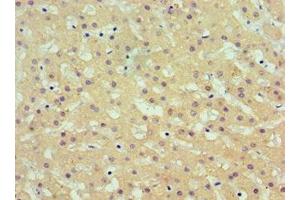 Immunohistochemistry of paraffin-embedded human liver tissue using ABIN7143695 at dilution of 1:100 (AKR1C4 Antikörper  (AA 1-323))