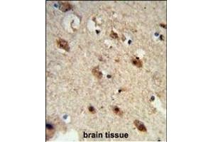 Immunohistochemistry (Paraffin-embedded Sections) (IHC (p)) image for anti-Acid Phosphatase 1, Soluble (ACP1) (AA 33-61), (N-Term) antibody (ABIN653360)