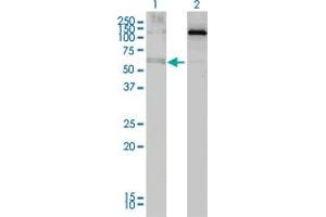 Western Blot analysis of ALAS2 expression in transfected 293T cell line by ALAS2 monoclonal antibody (M01), clone 6C1.