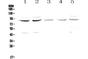 Western blot analysis of Cullin 4a using anti-Cullin 4a antibody . (Cullin 4A Antikörper  (AA 494-759))