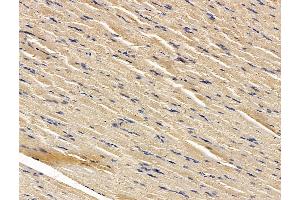 ABIN7096271 and ABIN7100333 at 1/100 staining rat muscle tissue by IHC-P. (RNF145 Antikörper)