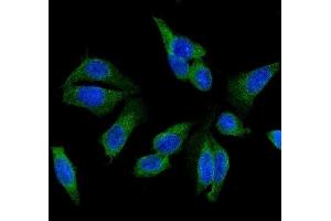IF analysis of GSTM1 using anti-GSTM1 antibody (ABIN5693234).