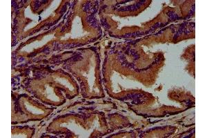 Immunohistochemistry (IHC) image for anti-Guanine Nucleotide Binding Protein, alpha Stimulating, Olfactory Type (GNAL) (AA 4-116) antibody (ABIN7154699)