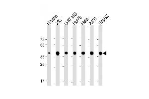 All lanes : Anti-TO Antibody (N-Term) at 1:2000 dilution Lane 1: Human brain lysate Lane 2: 293 whole cell lysate Lane 3: U-87 MG whole cell lysate Lane 4: Hut78 whole cell lysate Lane 5: Hela whole cell lysate Lane 6: A431 whole cell lysate Lane 7: HepG2 whole cell lysate Lysates/proteins at 20 μg per lane. (TOMM40 Antikörper  (AA 22-56))