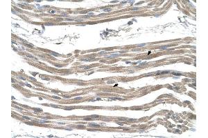 SLC25A22 antibody was used for immunohistochemistry at a concentration of 4-8 ug/ml to stain Skeletal muscle cells (arrows) in Human Muscle. (SLC25A22 Antikörper)