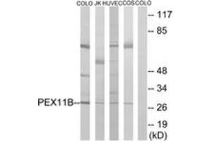 Western Blotting (WB) image for anti-Peroxisomal Biogenesis Factor 11 beta (PEX11B) (AA 91-140) antibody (ABIN2890490) (PEX11B Antikörper  (AA 91-140))
