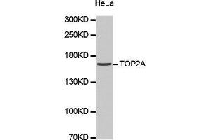 Western Blotting (WB) image for anti-Topoisomerase (DNA) II alpha 170kDa (TOP2A) antibody (ABIN1683096) (Topoisomerase II alpha Antikörper)